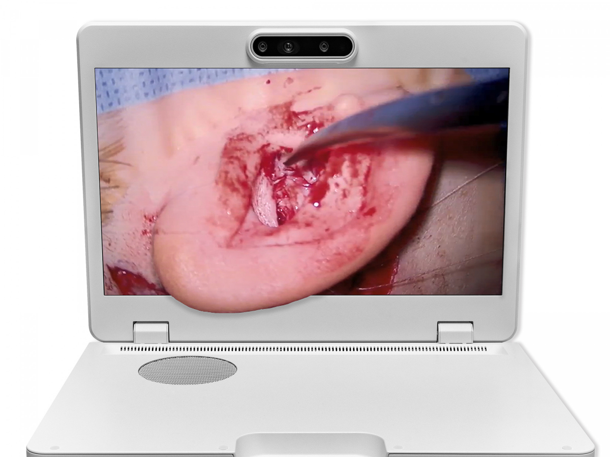 达擎之＂Heads-up 3D显微手术显示系统＂，整合4K裸眼3D显示及眼球追踪系统，具备快速追踪人眼移动位置功能，减轻医师长时间维持固定姿势的负担，让医师能有更宽广清晰的3D立体视野及更舒适的姿势来执行手术。